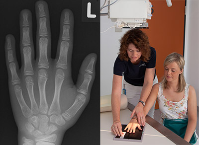 Hand Röntgenaufnahme